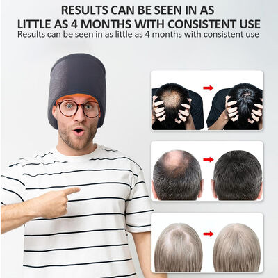 660nm Cap การเติบโตของผม LED การรักษาแสงแดง และ 270 LED แสงแดง และ Cap การรักษาด้วยเลเซอร์